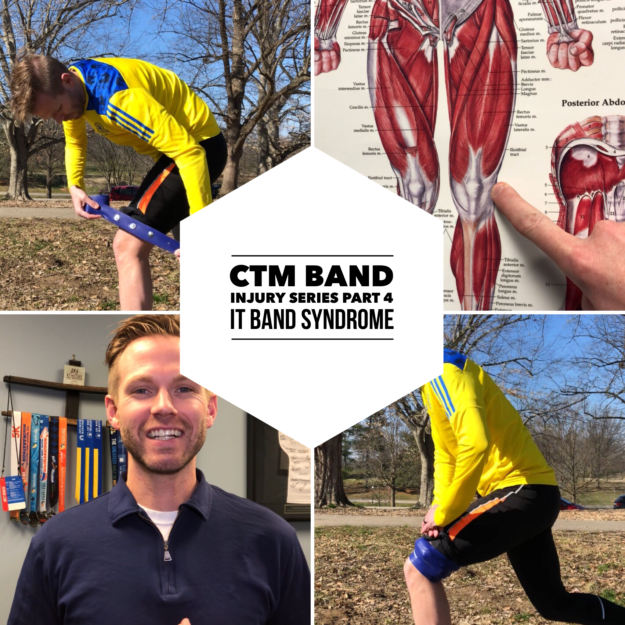 Image. The CTM Band is a soft tissue massage tool, achilles massage tool, hamstring massage tool, etc. It helps with pain on top of kneecap, patellofemoral pain syndrome, sore knees from running. ITB foam roller, illiotibial band foam roller.